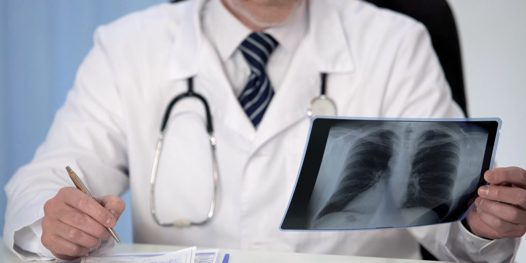 Doctor looking at lung patient's x-ray