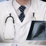 Doctor looking at lung patient's x-ray